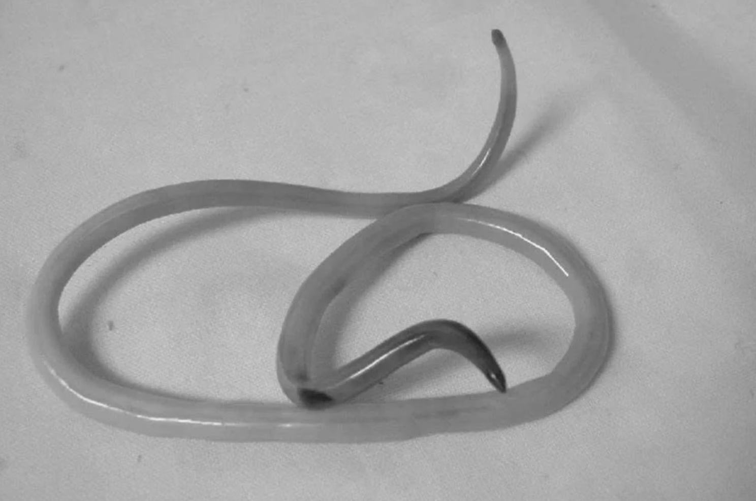 5 kebiasaan yang tanpa disadari dapat menyebabkan cacing gelang masuk ke dalam tubuh.